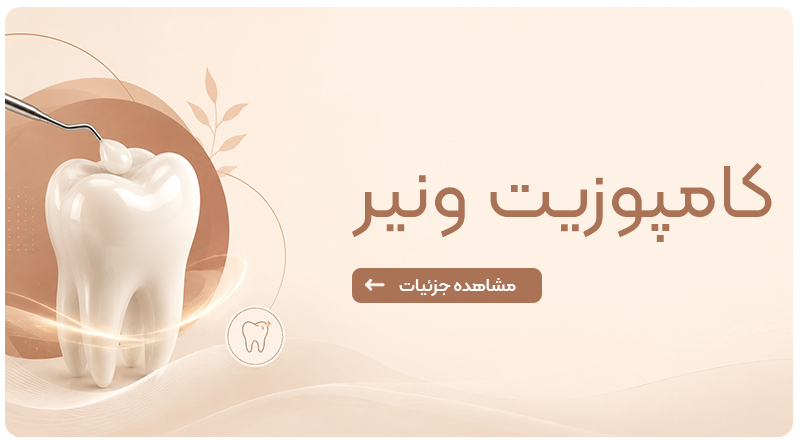کامپوزیت ونیر